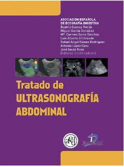 Tratado de ultrasonografía abdominal